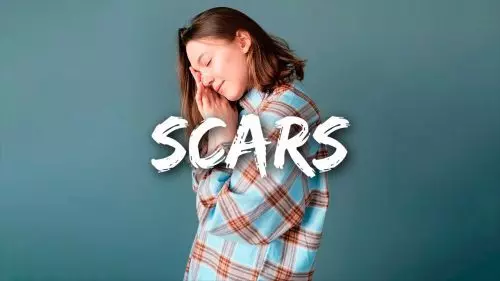Scars by JC Stewart